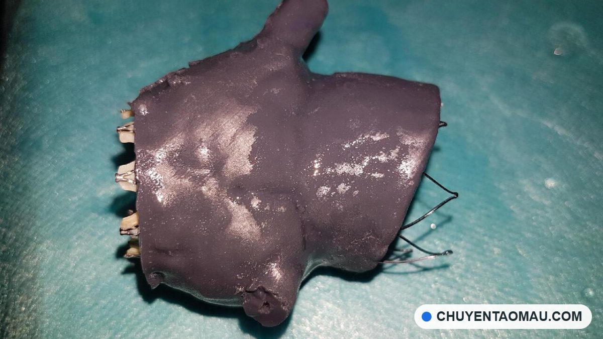 Biomedical 3D Printing in 2026: From “Made in Vietnam” Artificial Blood Vessels to Nitinol Stents and Dental Resins